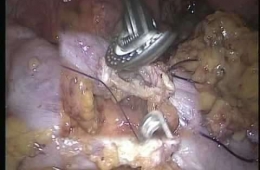 Nose Videosu, Prof Dr Turgut İpek