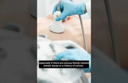 When should women start having breast examinations